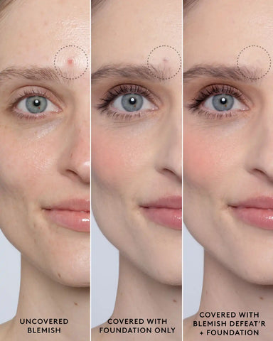 Blemish Defeat'r BHA Spot-Targeting Gel