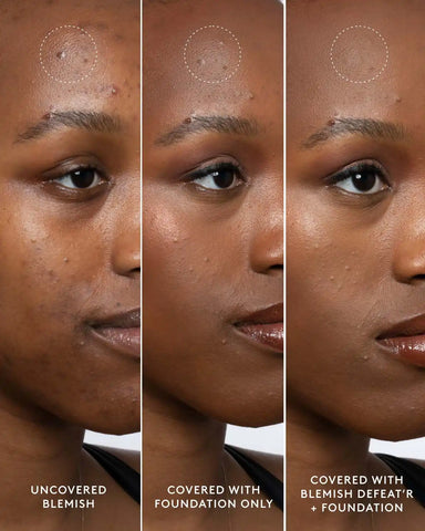 Blemish Defeat'r BHA Spot-Targeting Gel