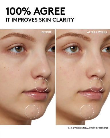 Cherry Dub Pore Purify'r Gel Cleanser with Niacinamide + Aloe Juice